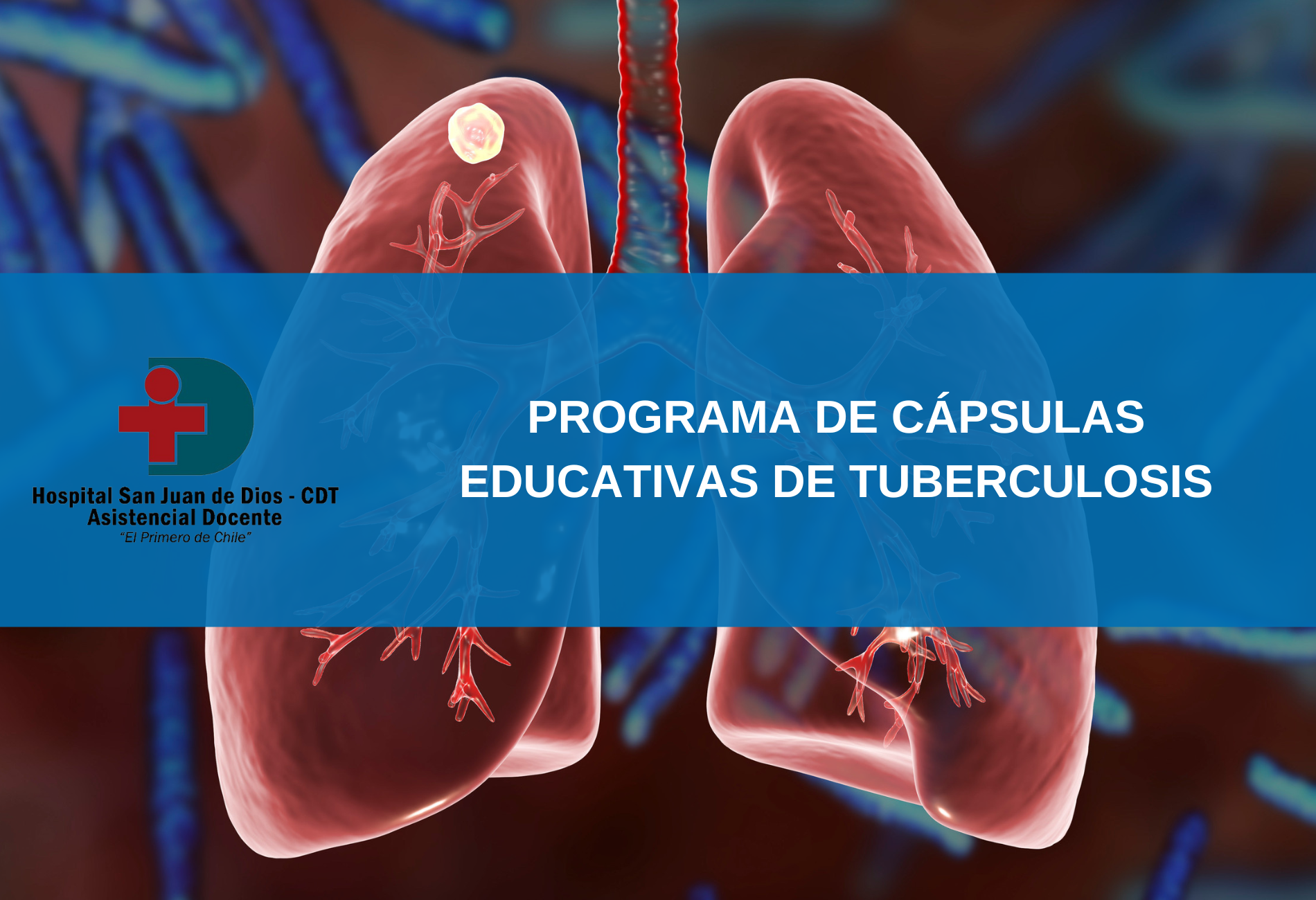 Programa de Cápsulas Educativas de Tuberculosis